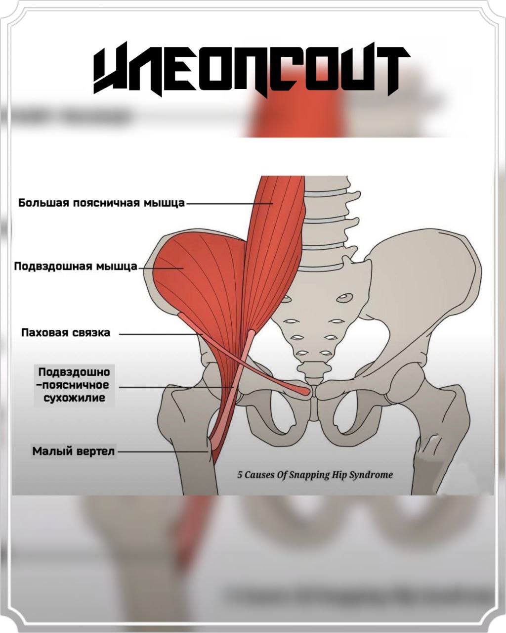 Малая поясничная мышца, m. PSOAS Minor