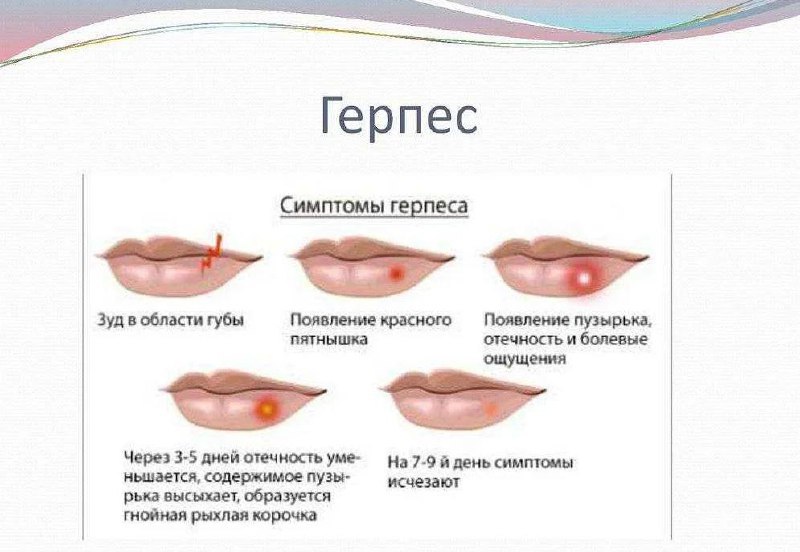 Какой бывает герпес на губах фото Post #3669 - ОПЫТНЫЙ ФАРМАЦЕВТ (2DUHJdFTKzgzMTFi)