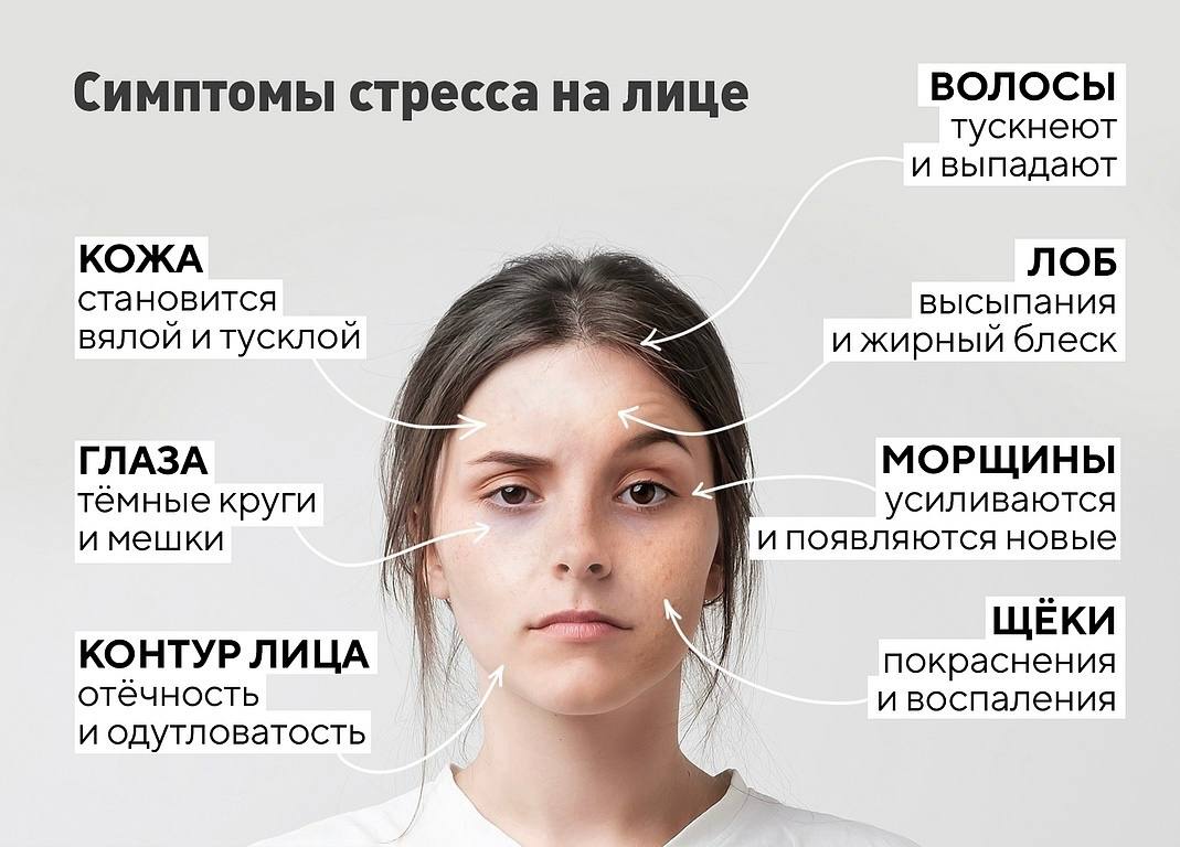 Как правильно снимать стресс Post #1510 - Зарабатывай со мной 